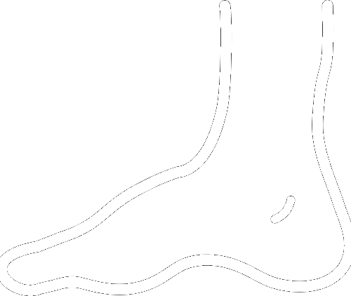 Varicose Veins