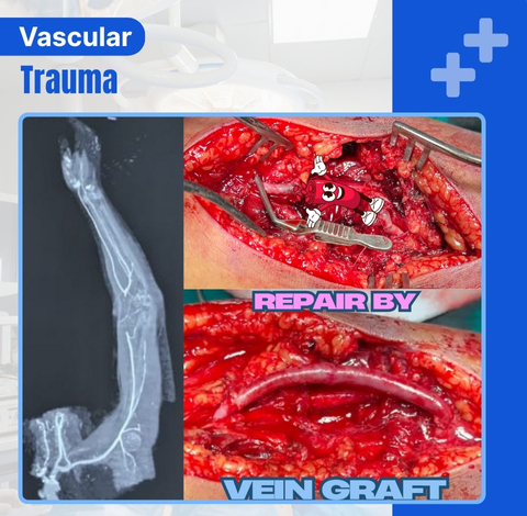 Vascular Trauma
