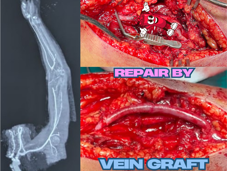 Vascular Trauma